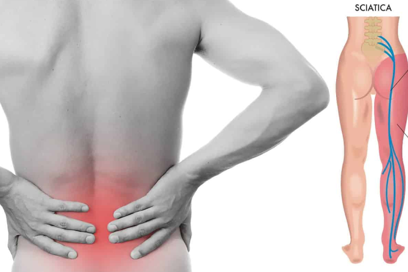 hip-and-lower-back-pain