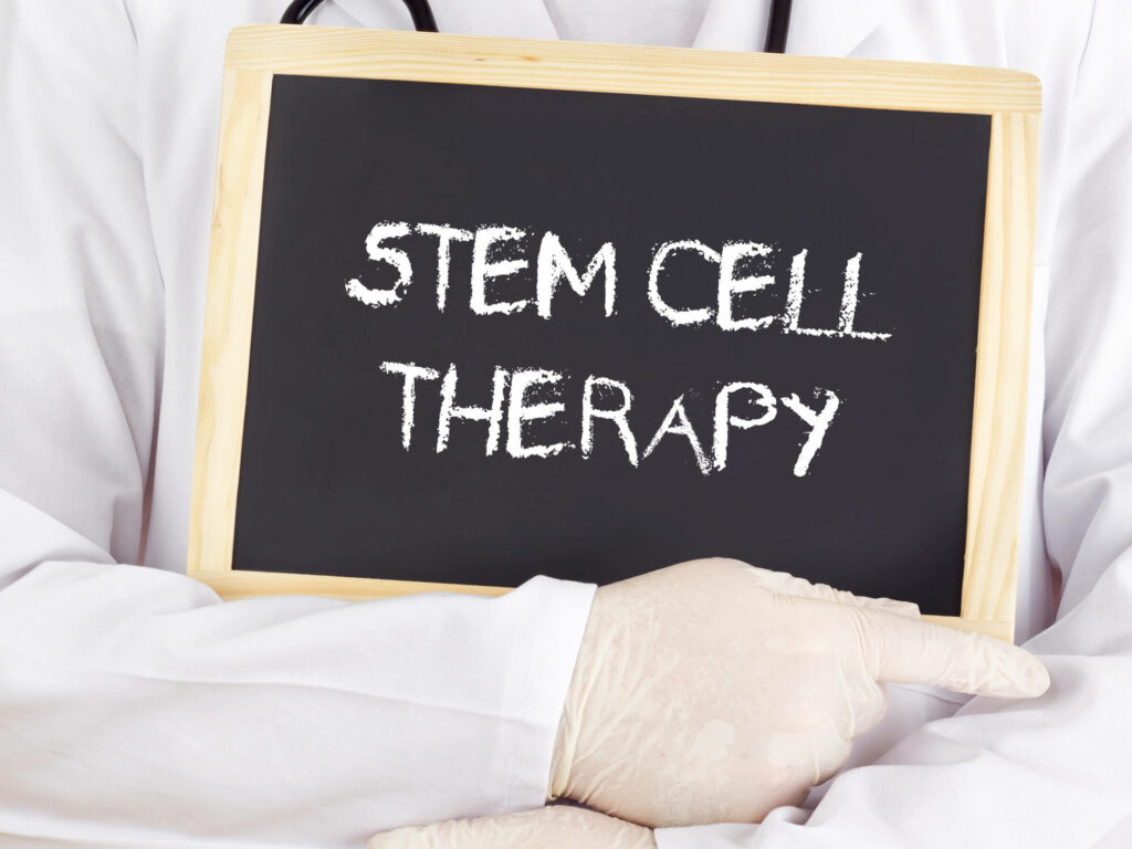 what is stem cell therapy written on board